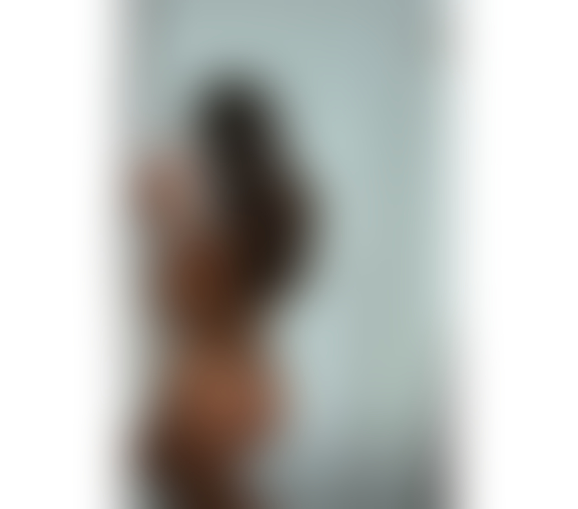 Escorts Hull Hull City Centre - Hull - Photos for Back In Town🔥 Alina🔥Top Girl